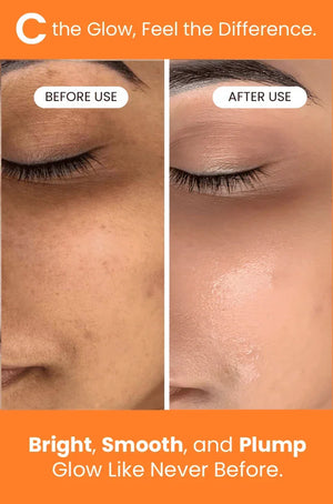 Before and after skin glow transformation showing brighter, smoother, plumper complexion