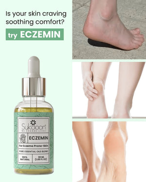 ECZEMIN pure essential oils blend for eczema prone skin, soothing natural relief for dry, itchy feet and legs