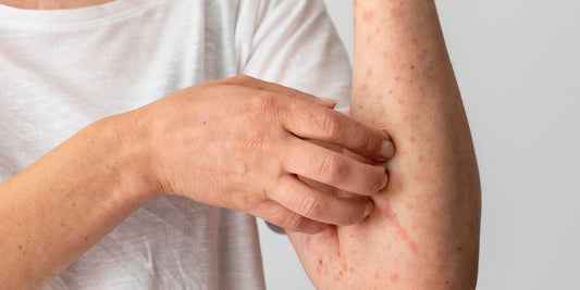 What Is the Reason for Skin Itching & Treatment