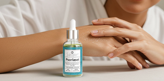 Psoriasis Treatment in Pakistan: Natural Remedies That Actually Work