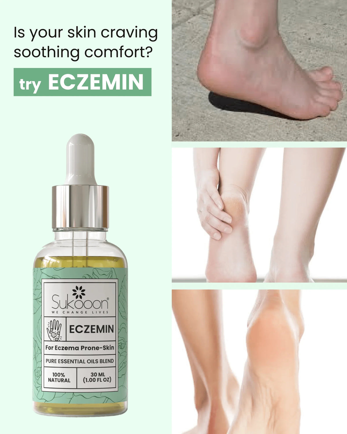 ECZEMIN pure essential oils blend for eczema prone skin, soothing natural relief for dry, itchy feet and legs